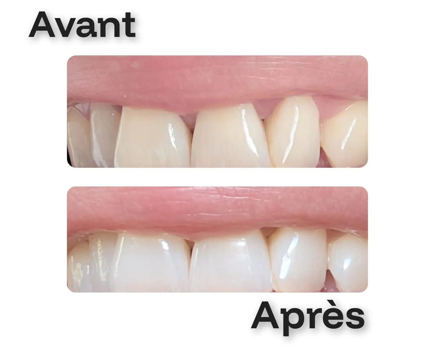 Colgate Max White kit blanchiment sérum nuit et dentifrice 2,5 ml + 75 ml