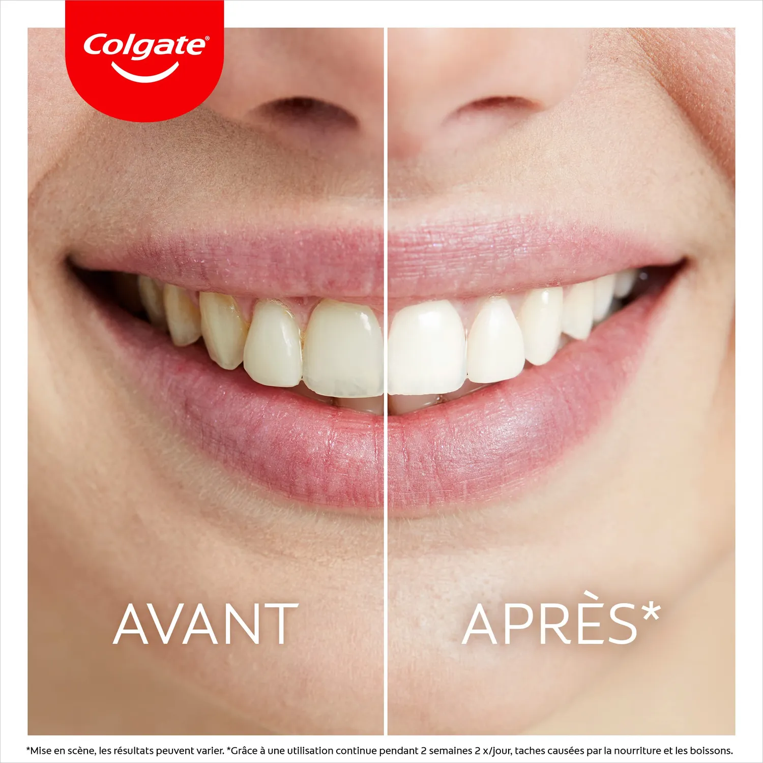 Colgate Max White Ultimate kit blanchiment LED à domicile sérum