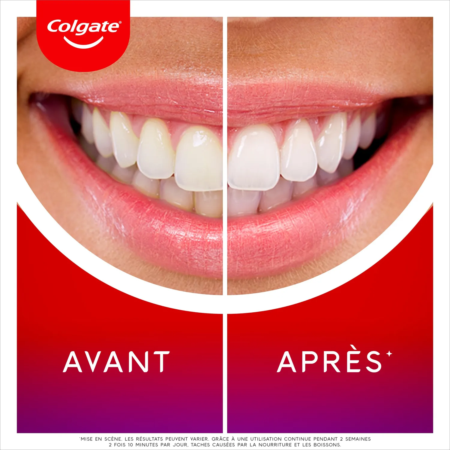 Colgate Max White Ultimate kit blanchiment LED charbon sérum