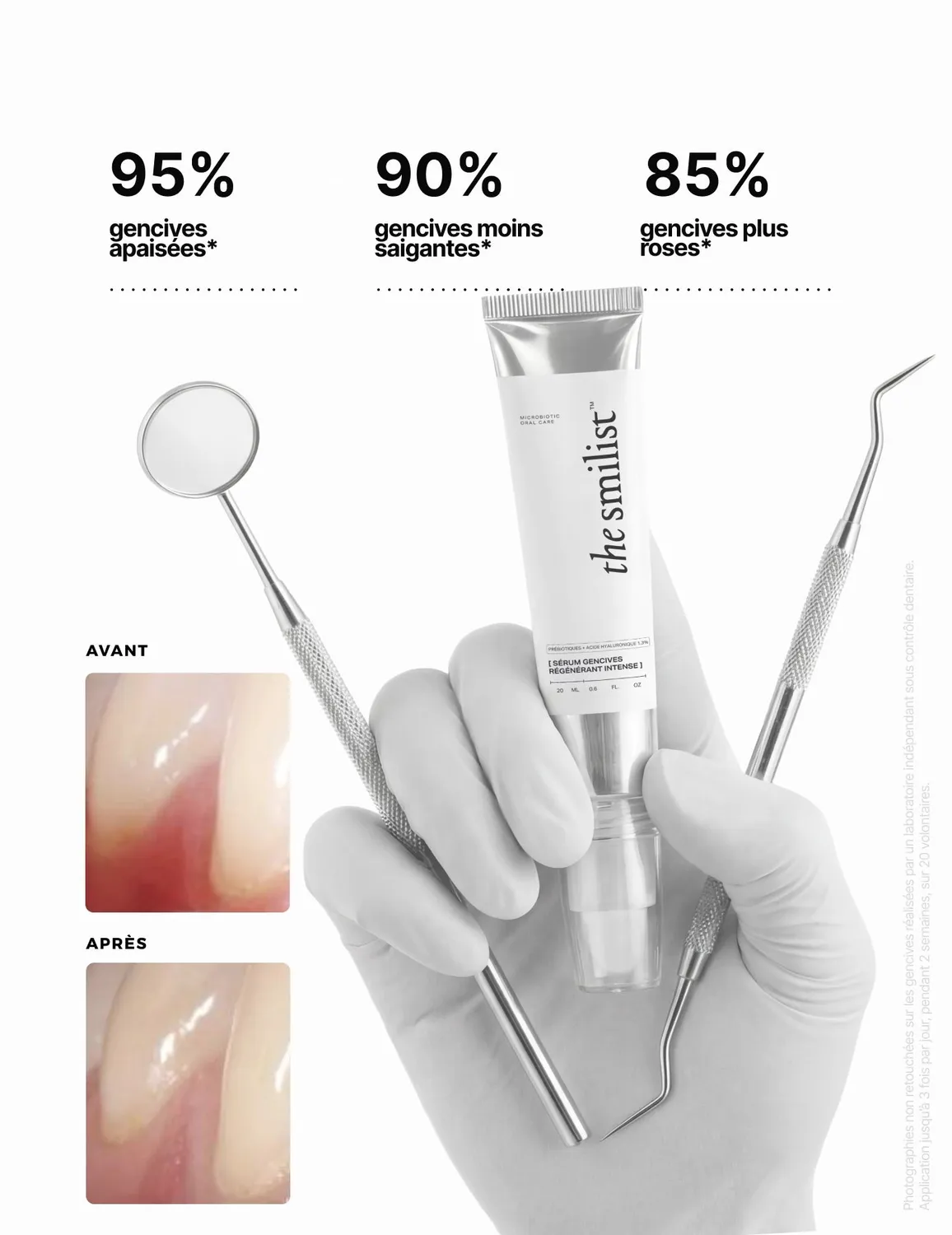 The Smilist Essential Gum kit soin des gencives